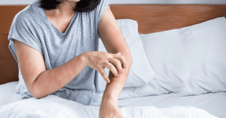 The Life Cycle of a Bed Bug: What You Need to Know